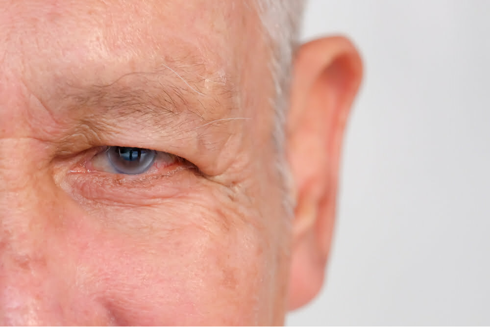 Glaucoma in Delaware.