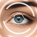 Eye on a person's face after refractive surgery