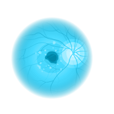 Retinal Treatment Icon